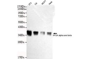 Western blot detection of A alpha and beta in Hela,MCF7,C6 and 3T3 cell lysates using A alpha and beta mouse mAb (1:2000 diluted). (PP2A alpha/beta 抗体)