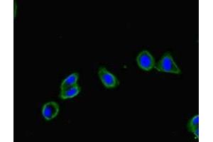 Immunofluorescent analysis of HepG2 cells using ABIN7152681 at dilution of 1:100 and Alexa Fluor 488-congugated AffiniPure Goat Anti-Rabbit IgG(H+L) (FRMD5 抗体  (AA 295-504))