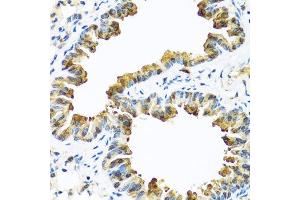 Immunohistochemistry (Paraffin-embedded Sections) (IHC (p)) image for anti-serpin Peptidase Inhibitor, Clade A (Alpha-1 Antiproteinase, Antitrypsin), Member 10 (SERPINA10) (AA 165-444) antibody (ABIN6147565)
