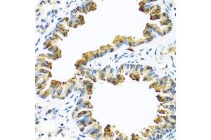 Immunohistochemistry of paraffin-embedded mouse lung using SERPINA10 antibody. (SERPINA10 抗体  (AA 165-444))