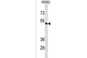 ZN Antibody (Center) (ABIN1537894 and ABIN2843344) western blot analysis in K562 cell line lysates (35 μg/lane). (ZNF733 抗体  (AA 156-183))
