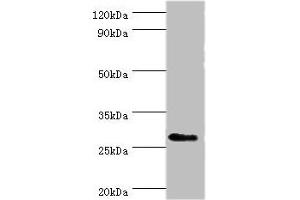 Western blot All lanes: CD48 antigen antibody at 7 μg/mL + Mouse thymus tissue Secondary Goat polyclonal to rabbit IgG at 1/10000 dilution Predicted band size: 28, 20 kDa Observed band size: 28 kDa (CD48 抗体  (AA 27-125))