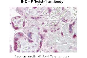 Image no. 2 for anti-Twist Homolog 1 (Drosophila) (TWIST1) (N-Term) antibody (ABIN347415) (TWIST1 抗体  (N-Term))