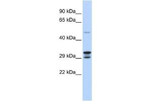 WB Suggested Anti-C14orf166 Antibody Titration:  0. (C14orf166 抗体  (N-Term))
