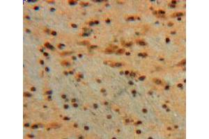 Used in DAB staining on fromalin fixed paraffin-embedded brain tissue (Galectin 3 抗体  (AA 1-262))
