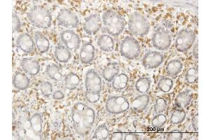 Immunoperoxidase of purified MaxPab antibody to SEPT12 on formalin-fixed paraffin-embedded human colon. (Septin 12 抗体  (AA 1-358))
