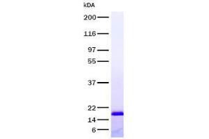 Validation with Western Blot (TNFRSF1A 蛋白)