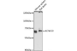 Western blot analysis of extracts of various cell lines using KCNK10 Polyclonal Antibody at dilution of 1:3000. (KCNK10 抗体)