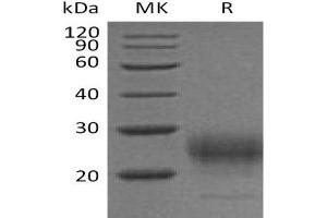 Western Blotting (WB) image for Interleukin 7 (IL7) (Active) protein (His tag) (ABIN7320603) (IL-7 Protein (His tag))