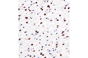 Immunohistochemical analysis of paraffin-embedded H. (NOVA1 抗体  (AA 139-173))