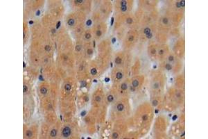 Used in DAB staining on fromalin fixed paraffin-embedded liver tissue (ROCK1 抗体  (AA 1094-1323))