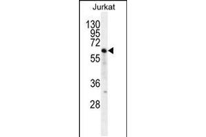 Western blot analysis in Jurkat cell line lysates (35ug/lane). (NKD2 抗体  (C-Term))