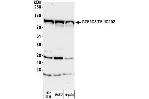 Western Blotting (WB) image for anti-General Transcription Factor 3C Polypeptide 3 (GTF3C3) (AA 475-525) antibody (ABIN7454731) (General Transcription Factor 3C Polypeptide 3 (GTF3C3) (AA 475-525) 抗体)