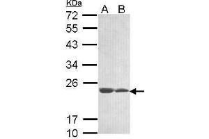 WB Image Sample (30 ug of whole cell lysate) A: 293T B: A431 , 12% SDS PAGE antibody diluted at 1:1000 (C11orf85 抗体  (Center))