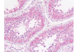 Testis, Human: Formalin-Fixed, Paraffin-Embedded (FFPE)