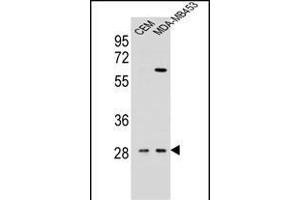 IL12B Antibody (C-term) (ABIN654420 and ABIN2844155) western blot analysis in CEM,MDA-M cell line lysates (35 μg/lane). (IL12B 抗体  (C-Term))