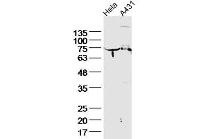 Lane 1, HeLa lysates, Lane 2, A431 lysate probed with Cytokeratin 2e Polyclonal Antibody, unconjugated  at 1:300 overnight at 4°C followed by a conjugated secondary antibody for 60 minutes at 37°C. (Keratin 2 抗体  (AA 251-350))