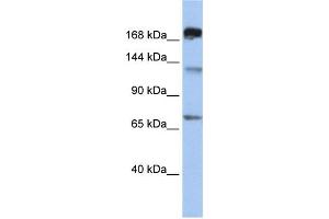 WB Suggested Anti-MTR Antibody Titration:  0. (MTR 抗体  (C-Term))