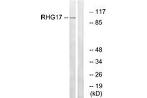 Western Blotting (WB) image for anti-rho GTPase Activating Protein 17 (ARHGAP17) (AA 331-380) antibody (ABIN2890584) (ARHGAP17 抗体  (AA 331-380))