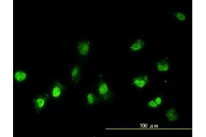 Immunofluorescence of monoclonal antibody to NEK11 on HeLa cell. (NEK11 抗体  (AA 1-482))