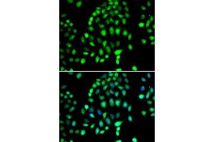 Immunofluorescence analysis of MCF-7 cells using P antibody (ABIN6132460, ABIN6145238, ABIN6145239 and ABIN6223130). (PARP3 抗体  (AA 301-540))