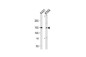 Western blot analysis of lysates from A431, K562 cell line (from left to right), using GALNT5 Antibody at 1:1000 at each lane. (GALNT5 抗体  (N-Term))