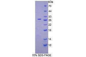SDS-PAGE analysis of Mouse Complement Receptor 2 Protein. (CD21 蛋白)