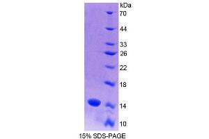 SDS-PAGE (SDS) image for S100 Calcium Binding Protein A9 (S100A9) (AA 1-113) protein (His tag) (ABIN1080760) (S100A9 Protein (AA 1-113) (His tag))