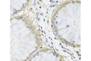 Immunohistochemistry of paraffin-embedded Human colon using MTX1 Polyclonal Antibody at dilution of 1:100 (40x lens). (Metaxin 1 抗体)