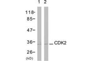 Western blot analysis of extracts from A2780 cells, using CDK2 (Ab-160) Antibody. (CDK2 抗体  (AA 131-180))
