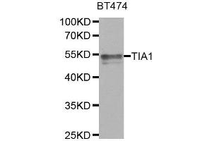 Western Blotting (WB) image for anti-TIA1 Cytotoxic Granule-Associated RNA Binding Protein (TIA1) antibody (ABIN1882364) (TIA1 抗体)