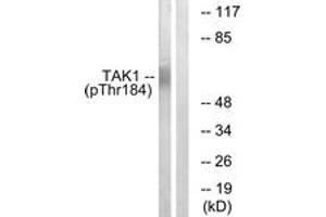 Western blot analysis of extracts from HepG2 cells treated with TNF 20ng/ml 5', using TAK1 (Phospho-Thr184) Antibody. (TR4 抗体  (pThr184))