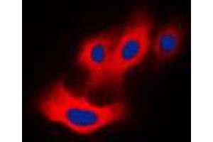 Immunofluorescent analysis of PAK4 (pS474) staining in Raw264. (PAK4 抗体  (C-Term, pSer474))