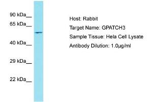 Host: Rabbit Target Name: GPATCH3 Sample Tissue: Human Hela Whole cell Antibody Dilution: 1ug/ml (GPATCH3 抗体  (C-Term))