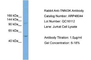WB Suggested Anti-TNNI3K  Antibody Titration: 0. (TNNI3K 抗体  (N-Term))