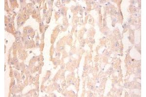 Immunohistochemistry (IHC) image for anti-phosphorylase, Glycogen, Liver (PYGL) (AA 2-846) antibody (ABIN7154210)