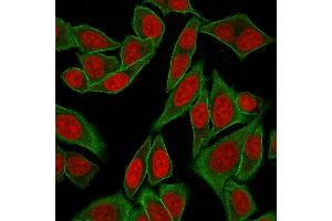 Immunofluorescence Analysis of Human HeLa cells labeling SPTBN2 with Spectrin beta III Rabbit Recombinant Monoclonal (SPTBN2/2887R) followed by Goat anti-mouse IgG-CF488 (Green). (Recombinant Spectrin, Beta, Non-erythrocytic 2 (SPTBN2) (AA 356-475) 抗体)