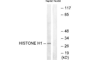 Immunohistochemistry analysis of paraffin-embedded human colon carcinoma tissue using Histone H1 (Ab-17) antibody. (Histone H1 抗体)