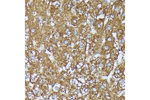 Immunohistochemistry of paraffin-embedded rat liver using C2 Rabbit pAb (ABIN7265549) at dilution of 1:100 (40x lens). (AKR1C2 抗体  (AA 1-323))