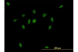 Immunofluorescence of monoclonal antibody to CSE1L on HeLa cell. (Exportin 2 抗体  (AA 872-971))