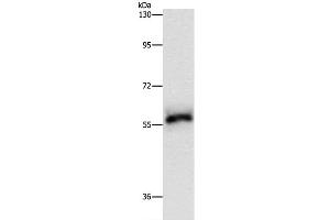 Western Blot analysis of Hela cell using HCK Polyclonal Antibody at dilution of 1:500 (HCK 抗体)