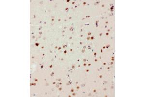 Anti-MEKK3 antibody, IHC(P): Rat Brain Tissue (MAP3K3 抗体  (N-Term))