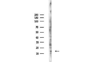 anti-Fibroblast Growth Factor 21 (FGF21) (C-Term) antibody