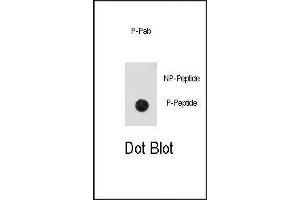 Image no. 1 for anti-Cyclin-Dependent Kinase 2 (CDK2) (pThr14) antibody (ABIN358539) (CDK2 抗体  (pThr14))