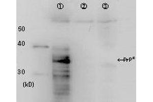 Western Blotting (WB) image for anti-Prion Protein (PRNP) antibody (ABIN2452081) (PRNP 抗体)