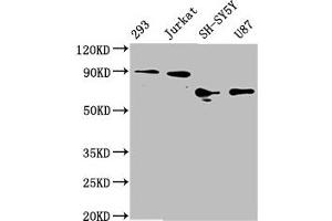 Western Blot Positive WB detected in: 293 whole cell lysate, Jurkat whole cell lysate, SH-SY5Y whole cell lysate, U87 whole cell lysate All lanes: FOXO3A antibody at 1. (Recombinant FOXO3 抗体)