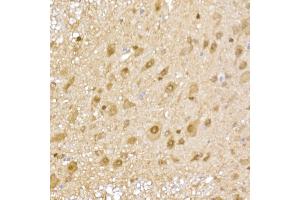 Immunohistochemistry (IHC) image for anti-Proteasome Subunit alpha 5 (PSMA5) (AA 1-241) antibody (ABIN6146304)