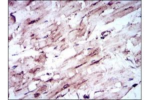 Immunohistochemical analysis of paraffin-embedded cardiac muscle tissues using SLC2A4 mouse mAb with DAB staining. (GLUT4 抗体  (AA 224-353))