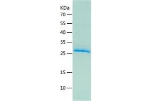 Epiregulin Protein (EREG) (AA 60-108) (His-IF2DI Tag)