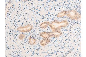 ABIN6267269 at 1/100 staining rat uterine tissue sections by IHC-P. (EGFR 抗体  (pSer1071))